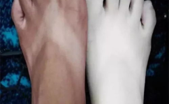 小姐姐脚底死皮脱落,揭秘小姐姐脚底死皮脱落的美肌蜕变之旅